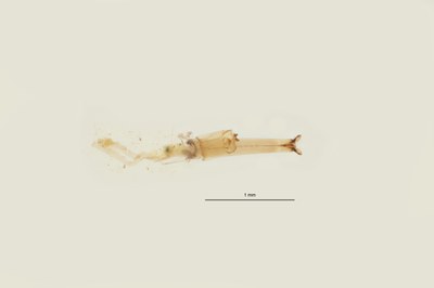 BE-RBINS-ENT Culex (Barraudius) modestus siphon V gel 2 M18L0462.jpeg BE-RBINS-ENT Culex (Barraudius) modestus siphon V gel 2 M18L0462.jpeg